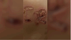 Marido é preso após marcar iniciais do nome dele no corpo da esposa no interior de SP