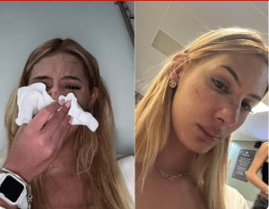 Jovem trans é agredida com soco no nariz e afirma ter sido vítima de transfobia  em Botucatu