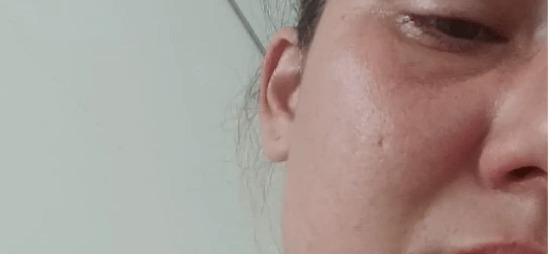 Capturar